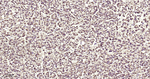 Aconitase 2 Recombinant Rabbit Monoclonal Antibody (8G6)