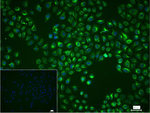 IMPDH2 Recombinant Rabbit Monoclonal Antibody (19E16)