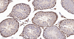 IMPDH2 Antibody in Immunohistochemistry (Paraffin) (IHC (P))