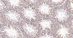 IMPDH2 Antibody in Immunohistochemistry (Paraffin) (IHC (P))