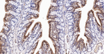 IMPDH2 Antibody in Immunohistochemistry (Paraffin) (IHC (P))