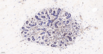 IMPDH2 Antibody in Immunohistochemistry (Paraffin) (IHC (P))