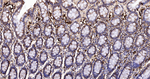 IMPDH2 Antibody in Immunohistochemistry (Paraffin) (IHC (P))