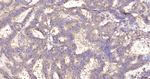 IMPDH2 Antibody in Immunohistochemistry (Paraffin) (IHC (P))
