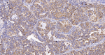 IMPDH2 Antibody in Immunohistochemistry (Paraffin) (IHC (P))