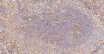 IMPDH2 Antibody in Immunohistochemistry (Paraffin) (IHC (P))