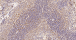 IMPDH2 Antibody in Immunohistochemistry (Paraffin) (IHC (P))