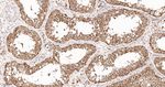 IMPDH2 Antibody in Immunohistochemistry (Paraffin) (IHC (P))