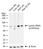 KARS Recombinant Rabbit Monoclonal Antibody (10G4)