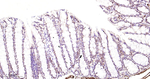 CtBP1 Antibody in Immunohistochemistry (Paraffin) (IHC (P))