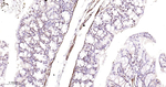 CtBP1 Antibody in Immunohistochemistry (Paraffin) (IHC (P))