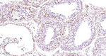 CtBP1 Antibody in Immunohistochemistry (Paraffin) (IHC (P))