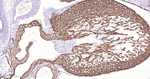 Cardiac Troponin C Recombinant Rabbit Monoclonal Antibody (11E5)