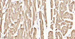 Cardiac Troponin C Antibody in Immunohistochemistry (Paraffin) (IHC (P))