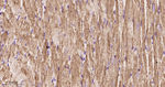 Cardiac Troponin C Antibody in Immunohistochemistry (Paraffin) (IHC (P))