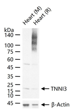 Cardiac Troponin C Antibody in Western Blot (WB)