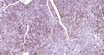 CBS Recombinant Rabbit Monoclonal Antibody (12G14)