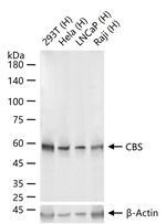 CBS Antibody in Western Blot (WB)