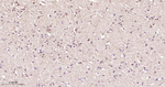 GUCY1B3 Antibody in Immunohistochemistry (Paraffin) (IHC (P))