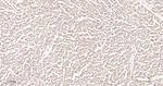 GUCY1B3 Antibody in Immunohistochemistry (Paraffin) (IHC (P))