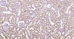 GUCY1B3 Antibody in Immunohistochemistry (Paraffin) (IHC (P))