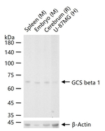GUCY1B3 Antibody in Western Blot (WB)