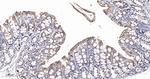 SFRP4 Antibody in Immunohistochemistry (Paraffin) (IHC (P))
