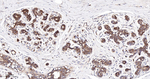 SFRP4 Antibody in Immunohistochemistry (Paraffin) (IHC (P))