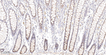 SFRP4 Antibody in Immunohistochemistry (Paraffin) (IHC (P))