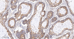 SFRP4 Antibody in Immunohistochemistry (Paraffin) (IHC (P))
