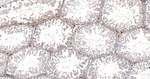SFRP4 Antibody in Immunohistochemistry (Paraffin) (IHC (P))