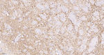 VAMP1 Antibody in Immunohistochemistry (Paraffin) (IHC (P))