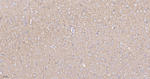 VAMP1 Antibody in Immunohistochemistry (Paraffin) (IHC (P))