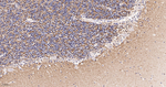 VAMP1 Antibody in Immunohistochemistry (Paraffin) (IHC (P))