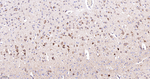 NDUFB8 Antibody in Immunohistochemistry (Paraffin) (IHC (P))