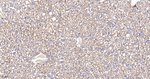 NDUFB8 Antibody in Immunohistochemistry (Paraffin) (IHC (P))
