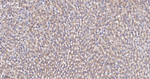 NDUFB8 Antibody in Immunohistochemistry (Paraffin) (IHC (P))