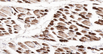 NDUFB8 Antibody in Immunohistochemistry (Paraffin) (IHC (P))