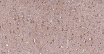 NDUFB8 Antibody in Immunohistochemistry (Paraffin) (IHC (P))