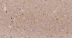 NDUFB8 Antibody in Immunohistochemistry (Paraffin) (IHC (P))