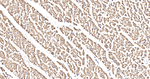 NDUFB8 Antibody in Immunohistochemistry (Paraffin) (IHC (P))