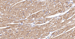 NDUFB8 Antibody in Immunohistochemistry (Paraffin) (IHC (P))