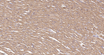 NDUFB8 Antibody in Immunohistochemistry (Paraffin) (IHC (P))