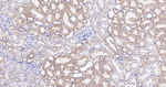 NDUFB8 Antibody in Immunohistochemistry (Paraffin) (IHC (P))