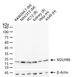 NDUFB8 Antibody in Western Blot (WB)