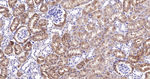 SULT2A1 Antibody in Immunohistochemistry (Paraffin) (IHC (P))