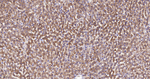 SULT2A1 Antibody in Immunohistochemistry (Paraffin) (IHC (P))
