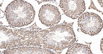 HnRNP Q Antibody in Immunohistochemistry (Paraffin) (IHC (P))
