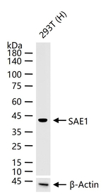 SAE1 Recombinant Rabbit Monoclonal Antibody (5G12)