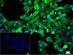 Destrin Recombinant Rabbit Monoclonal Antibody (7D3)